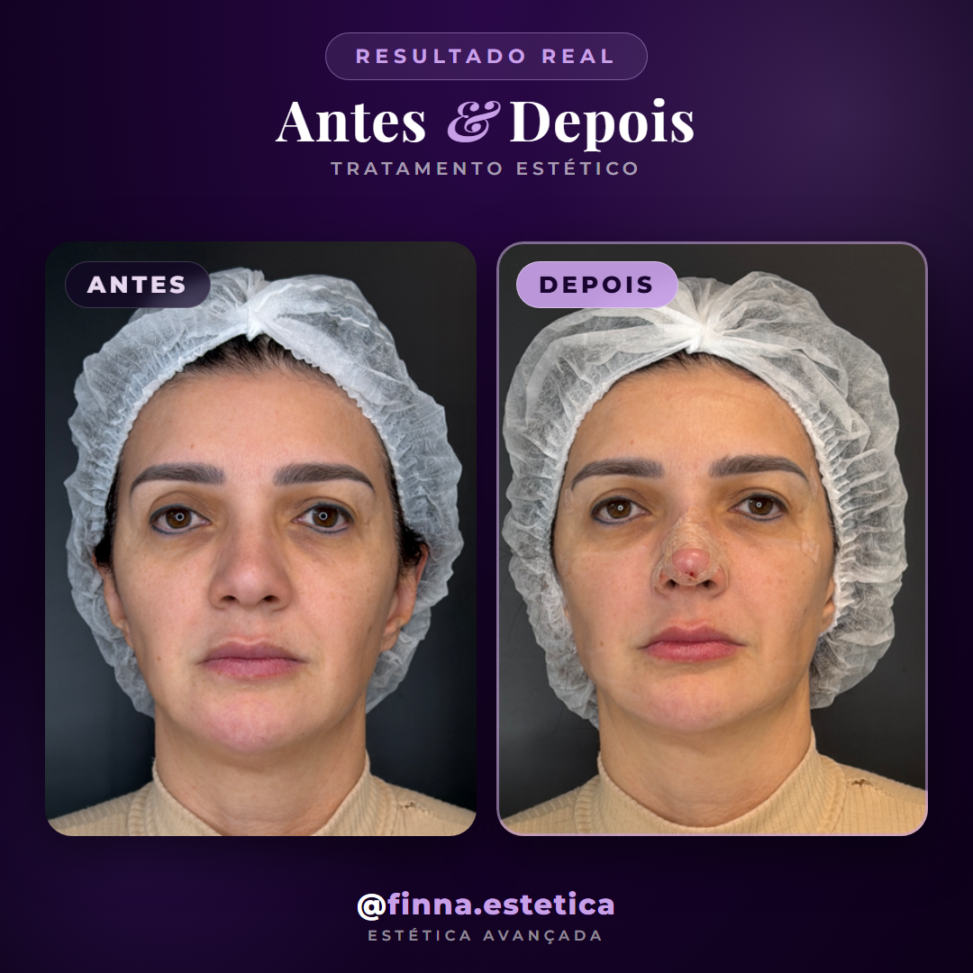 Estética facial